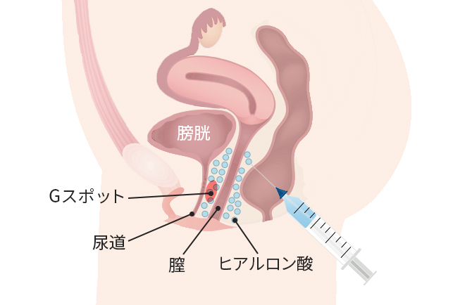 Gスポット開発とは？場所と位置の見つけ方 - 夜の保健室