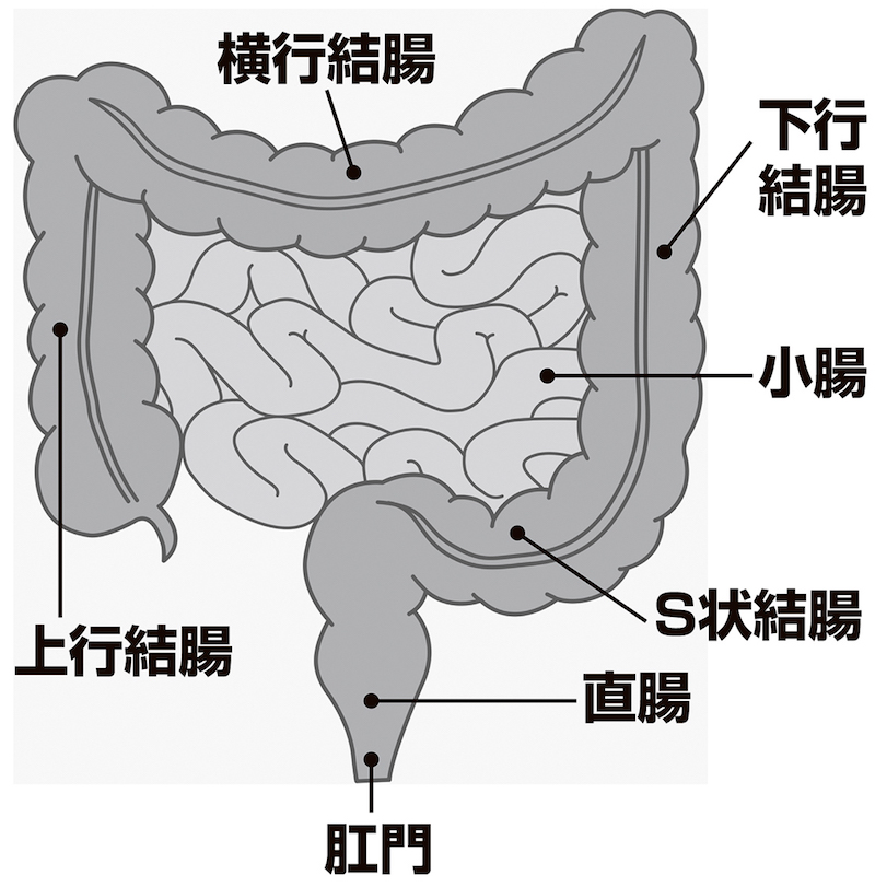 大腸がんとは？ ——その原因や症状 | メディカルノート