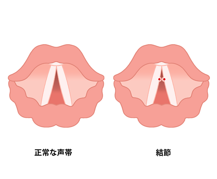 5種類セット】ガチャ ガチャガチャ コンプリート 中身