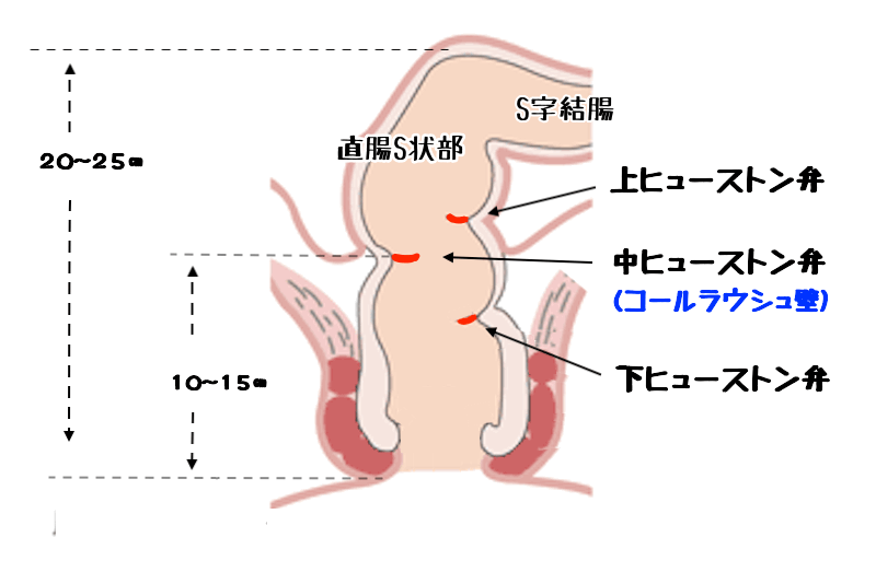 S字結腸法を受ける前後のアドバイス | タイSRS(性別適合手術)によるFtM/MtFのパイオニア Aqua Beauty