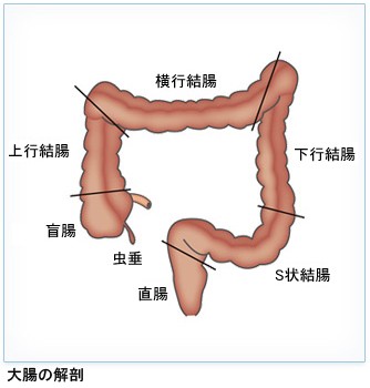 S状結腸の癒着による挿入困難で何かいい方法がありますか？ : 水浸法による無痛大腸内視鏡挿入マニュアル