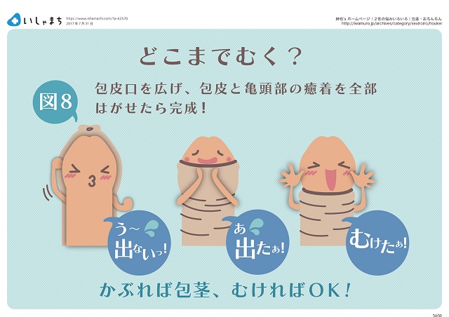 切らない包茎手術ってどういう事？ – メンズ形成外科 | 青山セレス&船橋中央クリニック