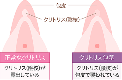 風俗嬢が画像で解説】クリトリスの感じる触り方知ってる?こんな触り方は絶対NG！ | Trip-Partner[トリップパートナー]