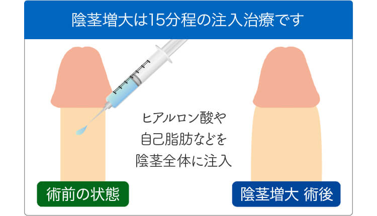 【日本人の陰茎（ペニス）サイズとＥＤ①】性交痛外来 女医が教える 日本人男性の平均陰茎サイズ（続編あり）