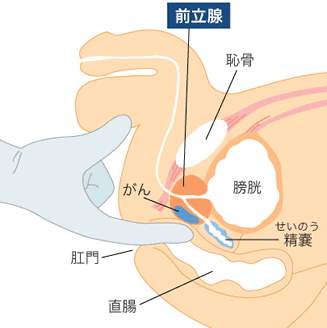 前立腺マッサージとはどんなプレイ？ 風俗エステ嬢がやり方を詳細解説 |