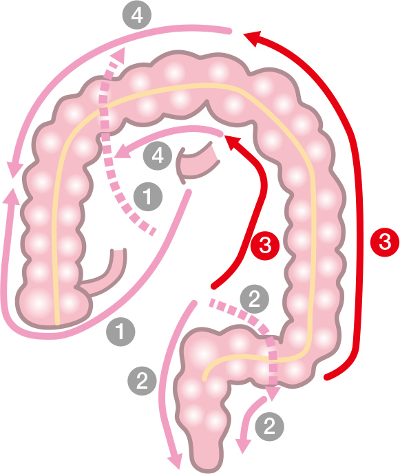 大腸がんとは | 国立がん研究センター 中央病院