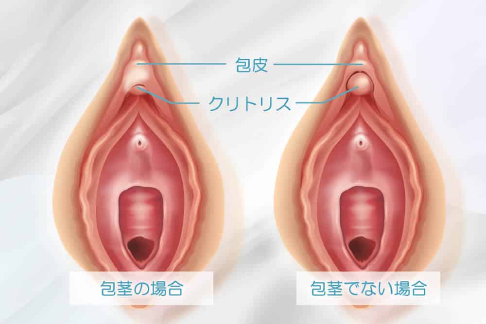 【クリトリス】痛くならない剥き方【大人の性教育】