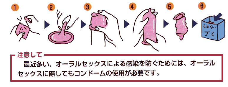 ふたりをまもる！基本的な避妊法【医師監修】 | セイシル