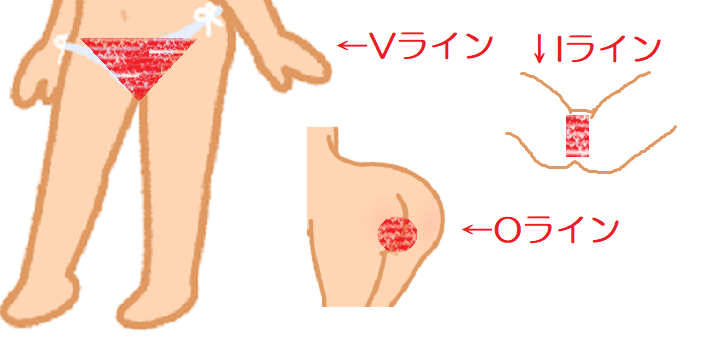 鳥肌必須！性病の中でゴムで防げない「毛じらみ」がもっとも厄介だと思う話【体験談】 - ぴくあぶ