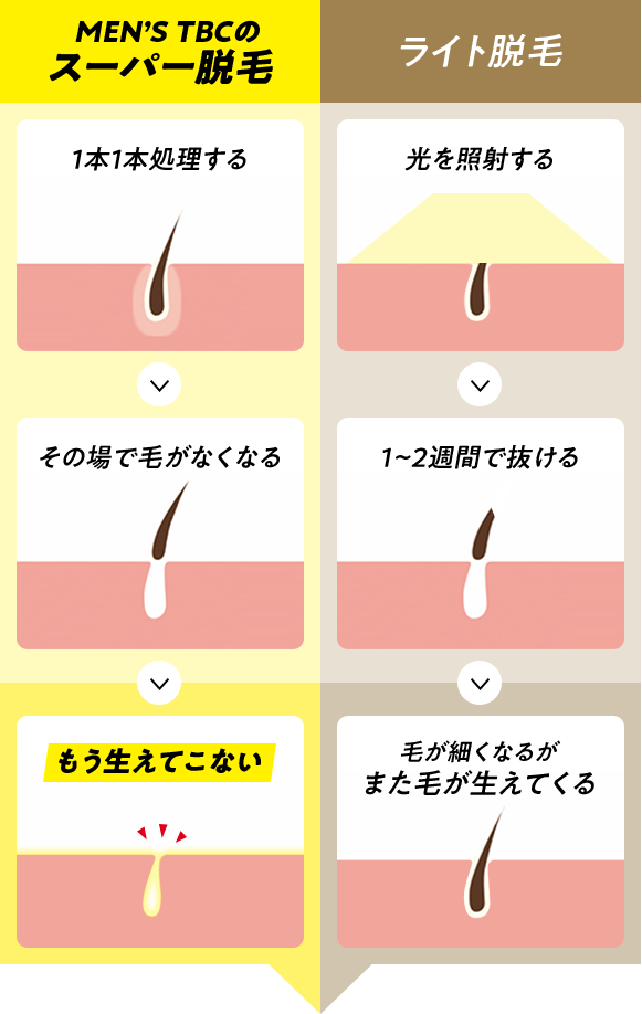 2024年12月最新】メンズTBCの脱毛総額は高い？ヒゲやスーパー脱毛料金はいくらか解説！支払い方法や口コミも紹介 | 脱毛ポータルサイト「エクラモ」