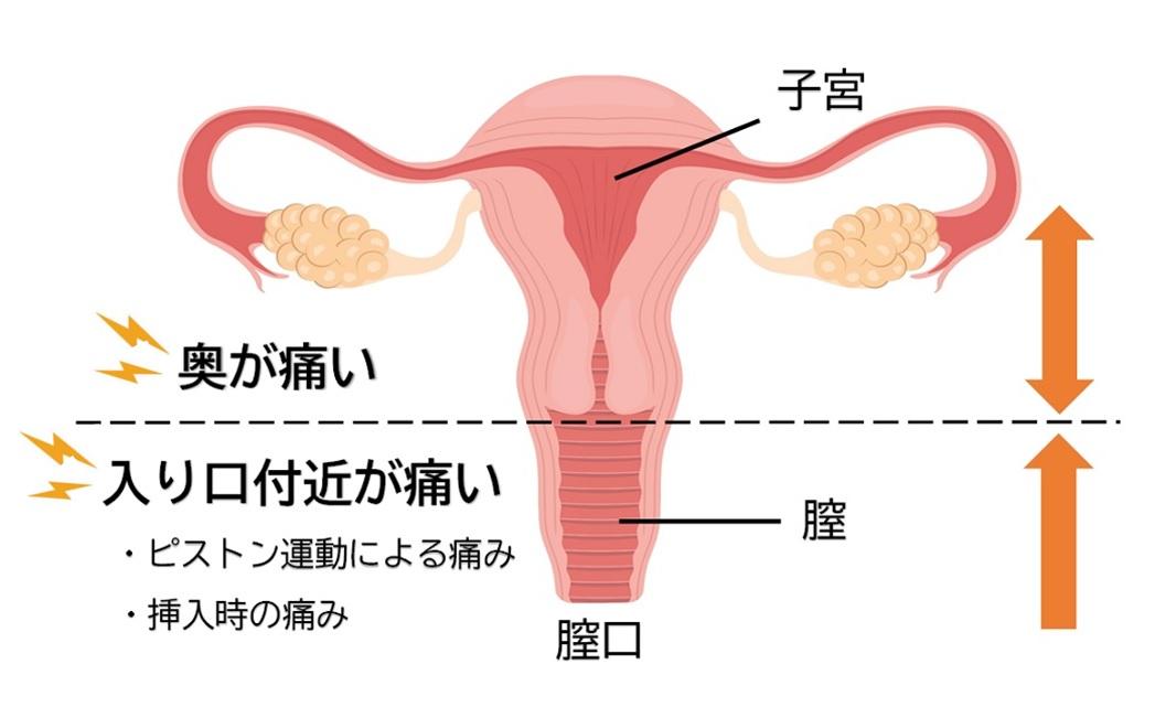 初めての挿入は痛い？初体験で入らない時の対処法 - 夜の保健室