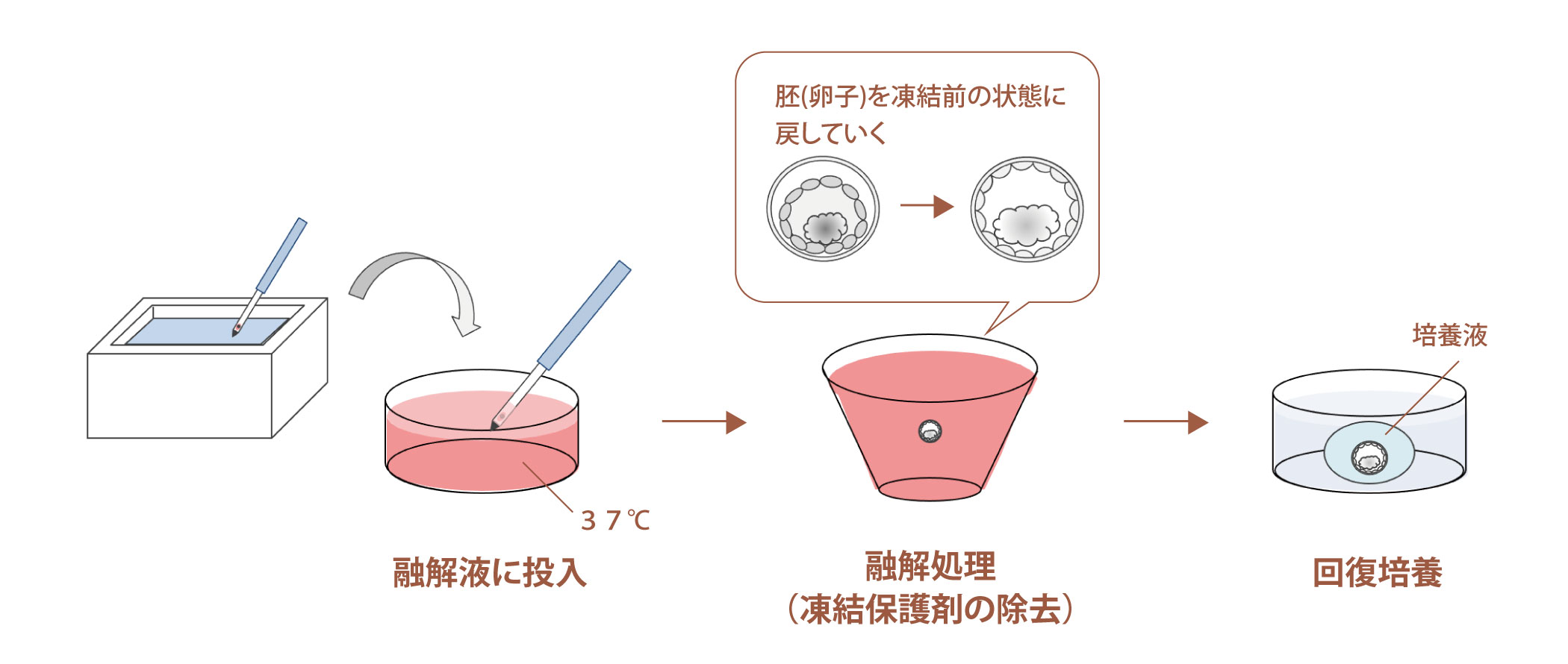 凍結・融解｜高崎ARTクリニック：不妊治療/体外受精/高度生殖医療