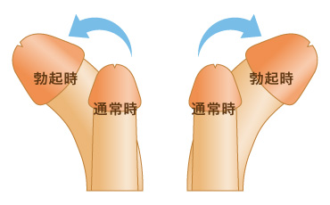 反りチンの原因は？欠点だけじゃないメリットと直し方も教えます！ | Trip-Partner[トリップパートナー]