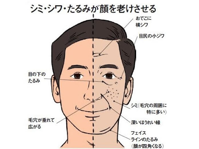 顔の脂肪吸引40代の体験談！1週間の顔痩せ効果とダウンタイムを公開！ - 銀座院