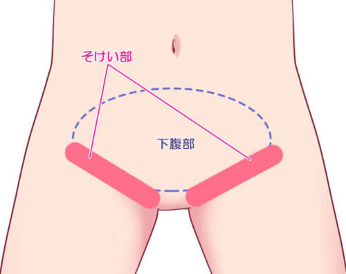 膣ポルチオ欲求奴○(くろすかんとりい。) - FANZA同人