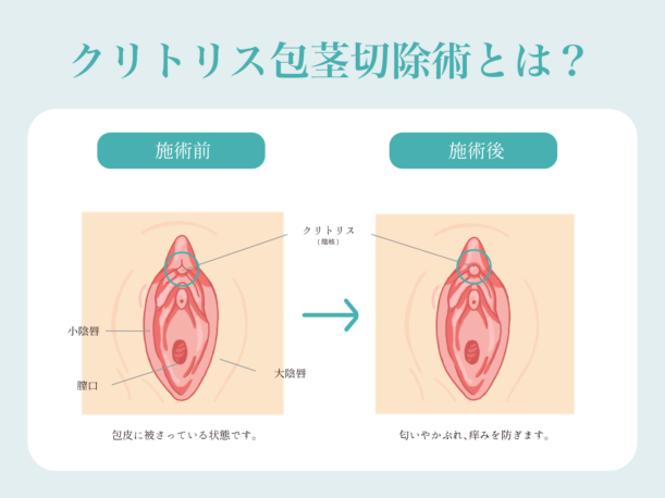 リアルな写真画像品質、８ｋ画像品質、(全裸、クリトリスを見せて、私の膣を見せて、美しい性器を見せる、全身のヌード、脚を広げる - SeaArt AI