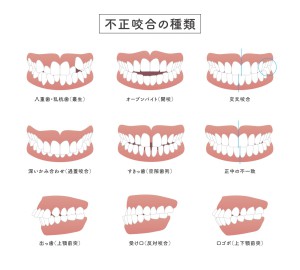 ストレスは唇の動きで読み取れる