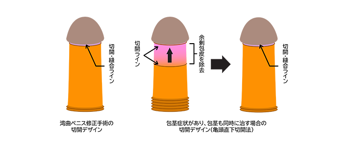 ペニスが勃起しても上向きにさせてもらえず下向きのままちんぽを叩かれたので金玉にも衝撃が伝わり感じてしまった僕