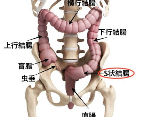 大腸がん | 独立行政法人 労働者健康安全機構