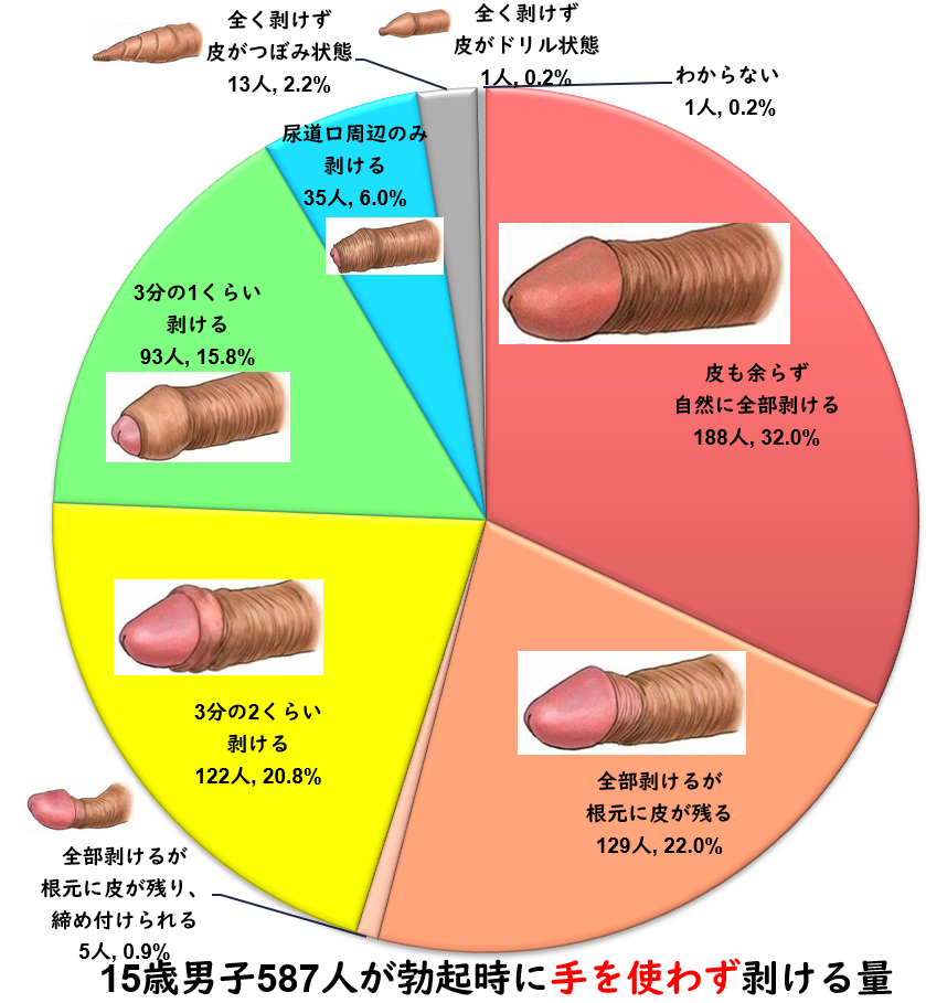 夜間陰茎勃起現象 - Wikipedia