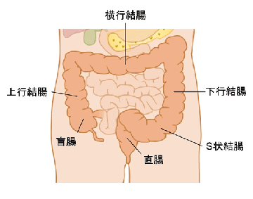 S状結腸がん-治療に役立つ知識と情報 漢方医学療法研究会