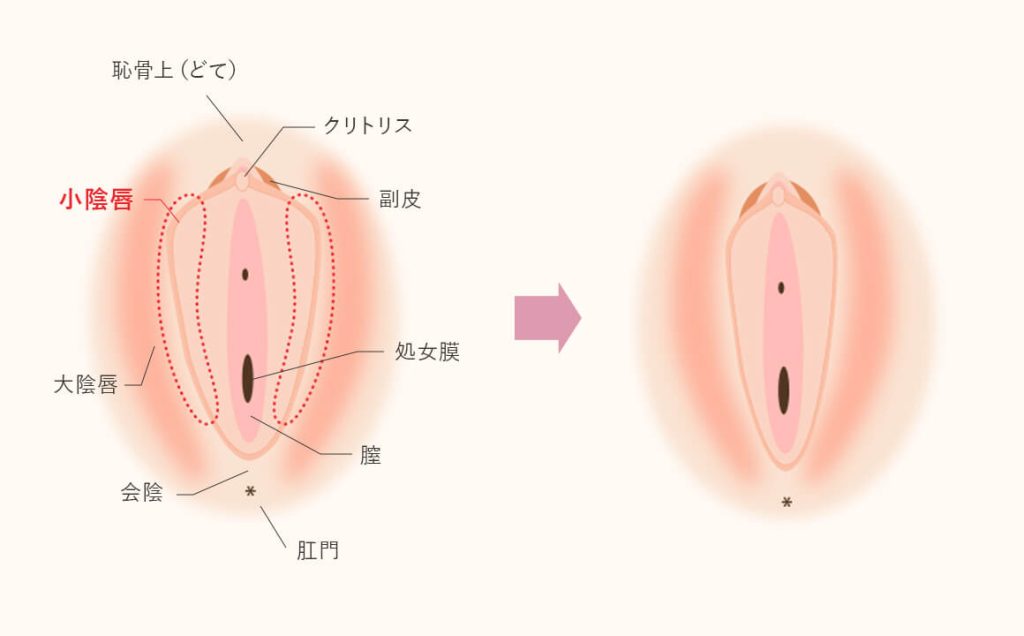 女性器の上付き・下付きの違いやチェック方法は？ それぞれの気持ちいい体位って？ ｜ iro iro