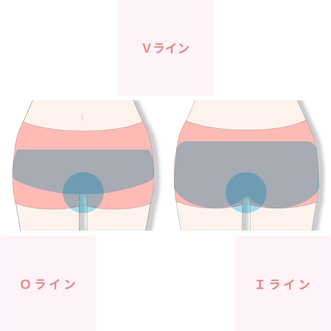 消化器外科 おなかのヘルニアセンター｜診療科・部門のご案内｜近畿大学奈良病院