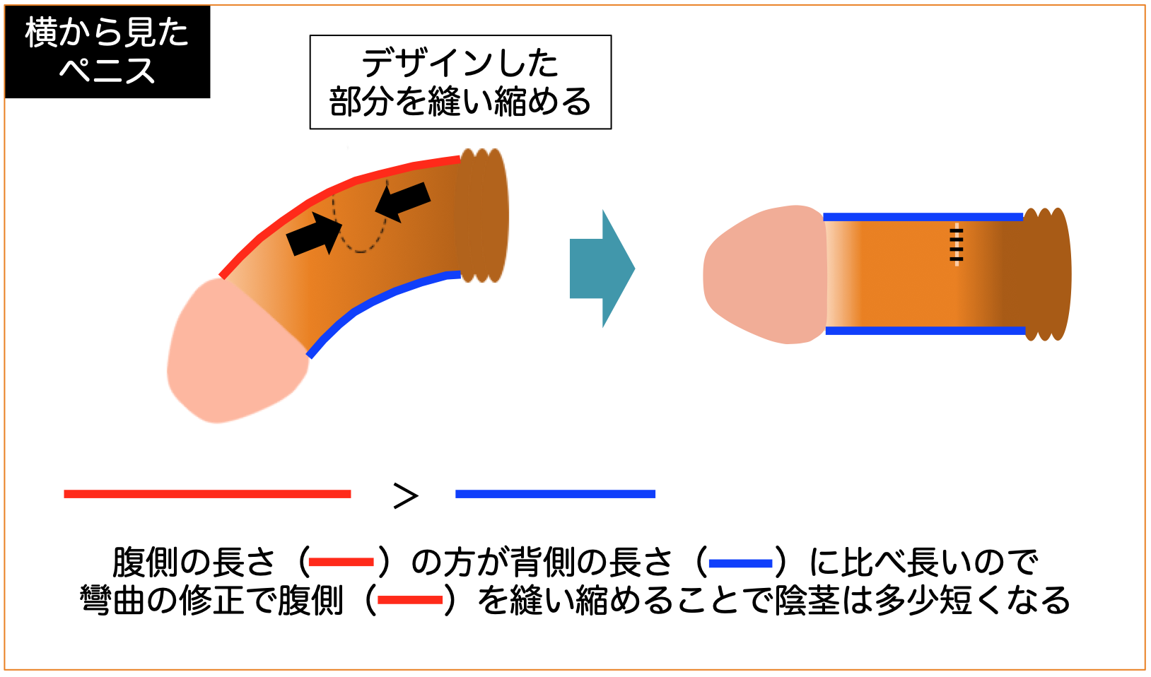 勃起角度を上反りにしたい！下反りちんこでは女性は物足りない？