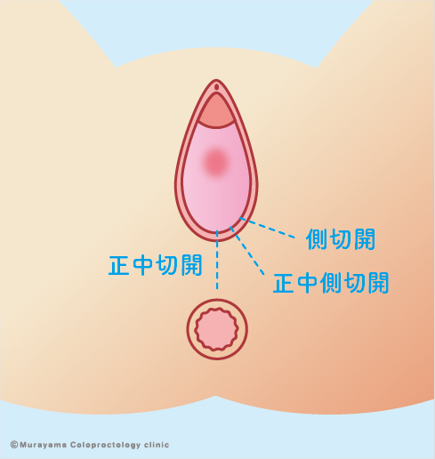 アナルセックスってどうなの？ 経験者に聞いてみた