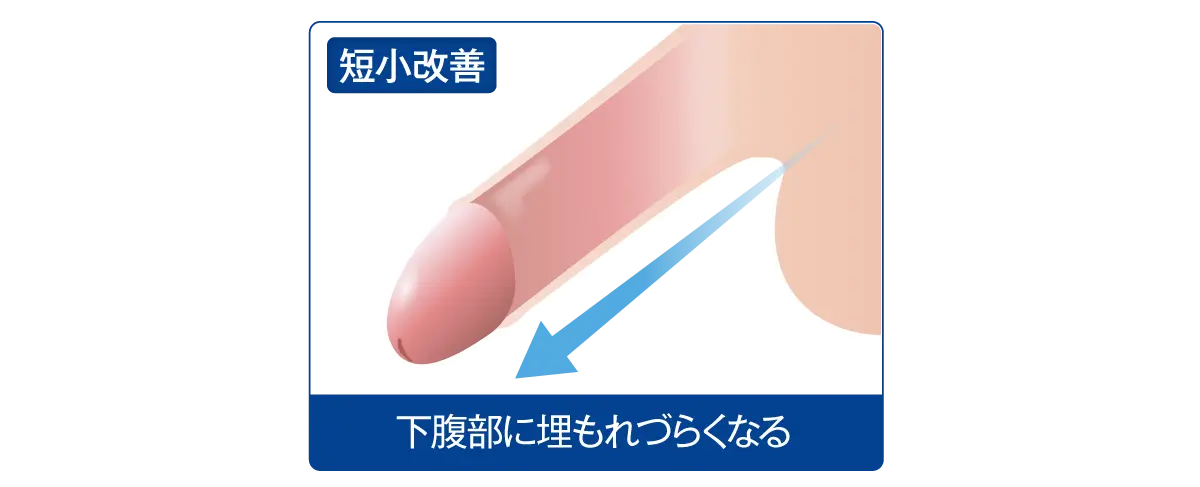 腰痛・肩こり・慢性疾患 | 伊勢原すいな鍼灸治療院 |