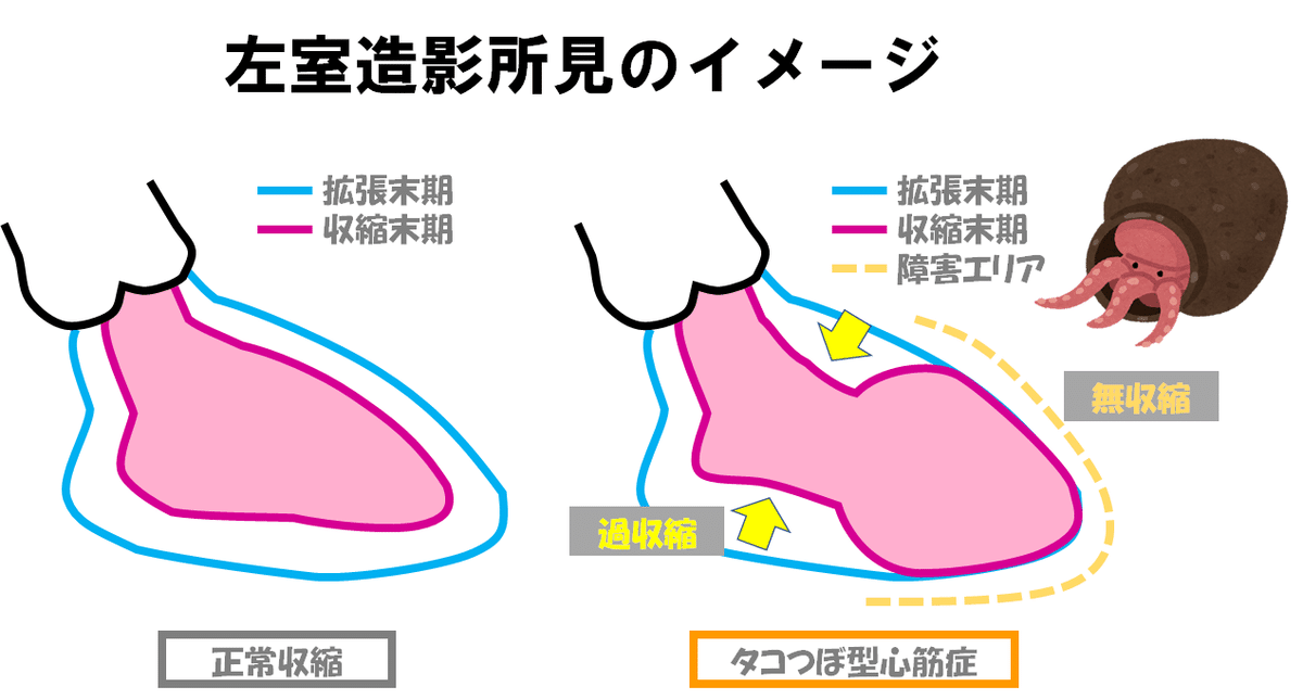 AV女優 愛沢ひなOJ オナホール体験レビュー