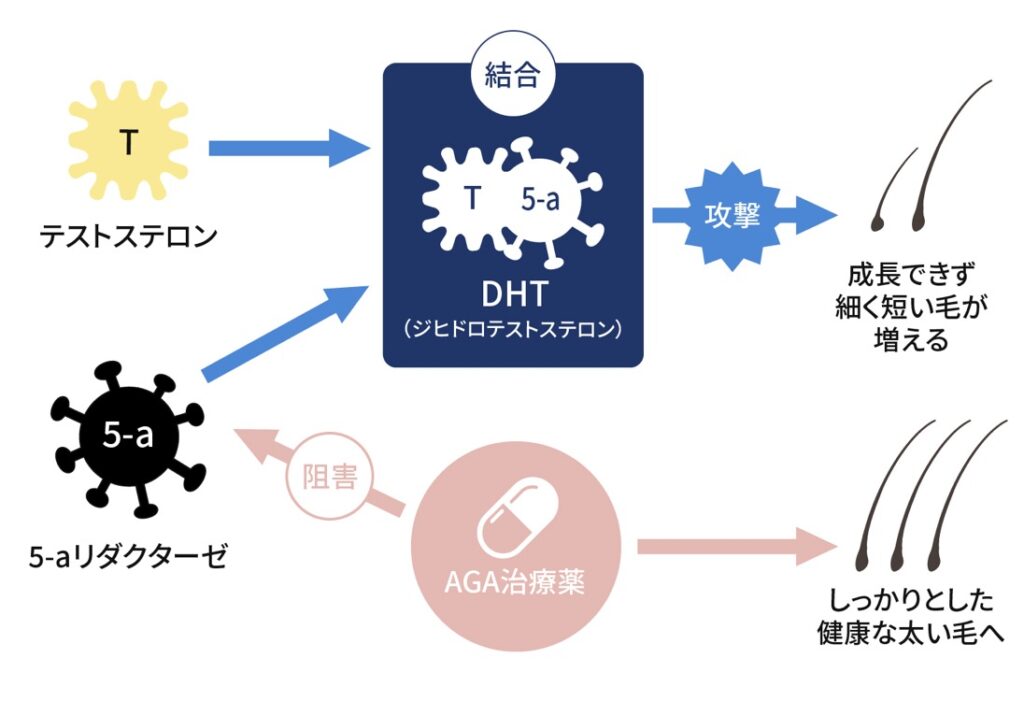 オナニーが髪に与えるデメリットとは？薄毛や抜け毛になるのかを解説 | 駅前AGAクリニック【新宿、北千住、大阪、京都、岡山、鹿児島など】