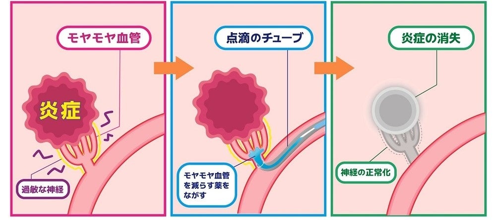 前立腺刺激＆金玉責め リング付き 9種類振動 アナルバイブ｜アダルトグッズ価格比較db