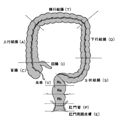 結腸がんの手術 | 下部消化管外科 - 名古屋市立大学