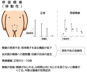 子どもの包茎」むきむき体操（包皮翻転指導）のすすめ – いしゃまち