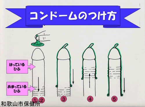 避妊失敗】避妊してたのに予期せぬ妊娠 ｜上野駅前婦人科クリニック