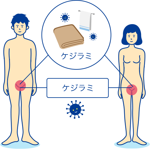 毛じらみ 気持ち悪い 爪