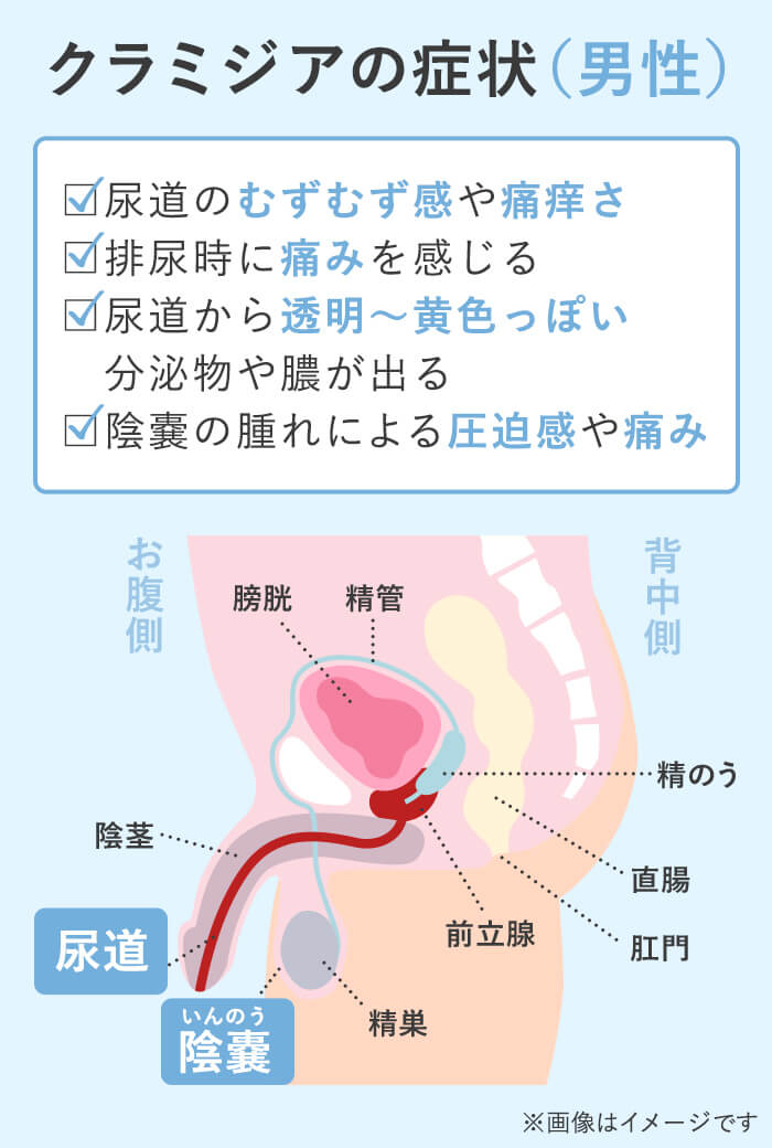 性行為感染症（性病関連） ｜ 烏丸御池院