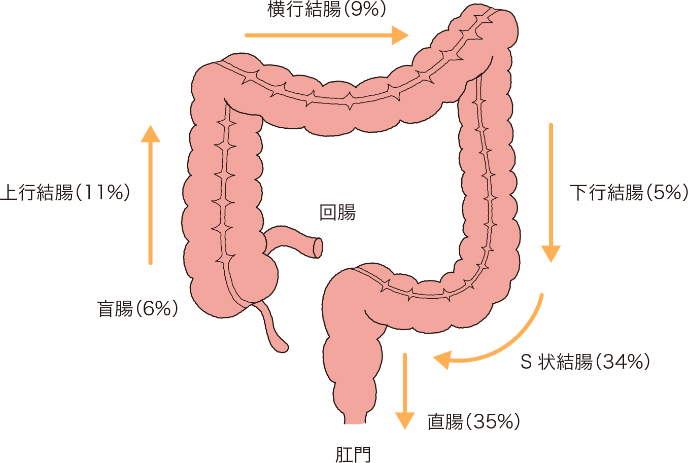 画像あり】S状結腸軸捻転とは？原因、症状、CT、治療まとめ！