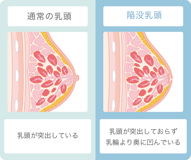 乳首が立つ理由って？寒い時など日常で乳首が立って困る場合の対処法 - 夜の保健室