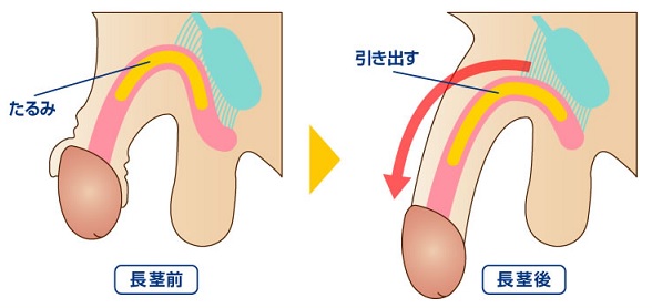 チントレ」の定番タグ記事一覧｜note ――つくる、つながる、とどける。