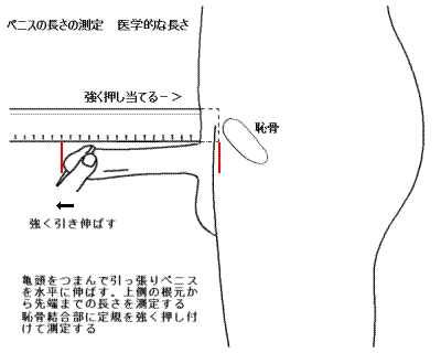 短小包茎とは！短小は何センチから？日本人の平均サイズや治療法 - アトムクリニック - atom-clinic