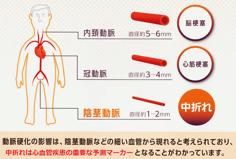 中折れ」の世代別の原因と改善方法｜竹越昭彦院長コラム【浜松町第一クリニック】