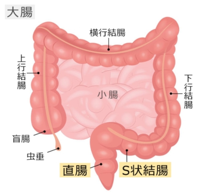 大腸がん | 生活習慣病