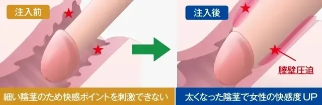 あそこの大きさの秘密！男性の身長とペニスのサイズの関係/ラブナイト【恋本コラム】