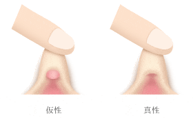 【クリトリス】痛くならない剥き方【大人の性教育】