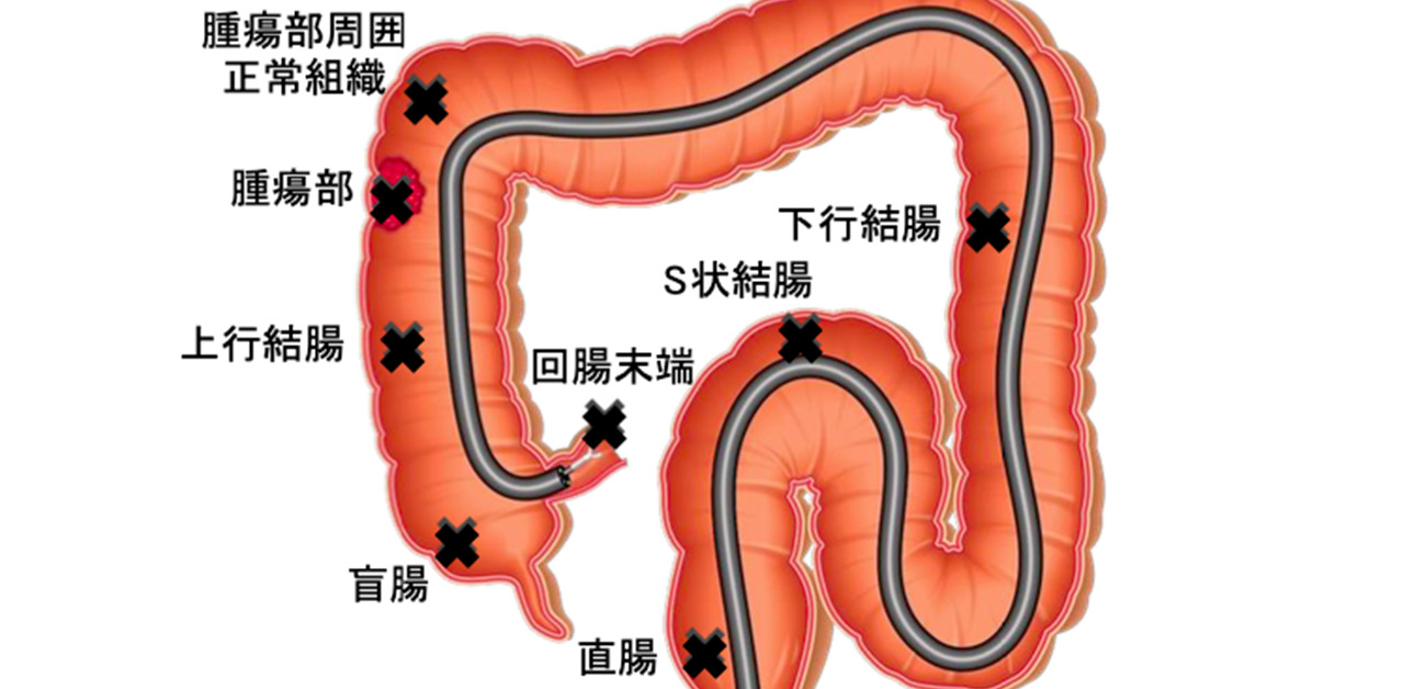 大腸の解剖用語 (ガストロ用語集 2023 「胃と腸」47巻5号より)｜gastropedia（ガストロペディア） 消化器にかかわる医療関係者のために