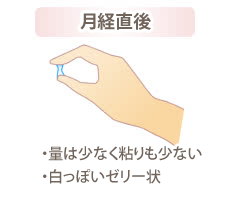 おりものに白い塊は病気のサイン？考えられる原因と対処法！病院を受診する目安も | 二宮レディースクリニック【泌尿器科・婦人科・アートメイク】