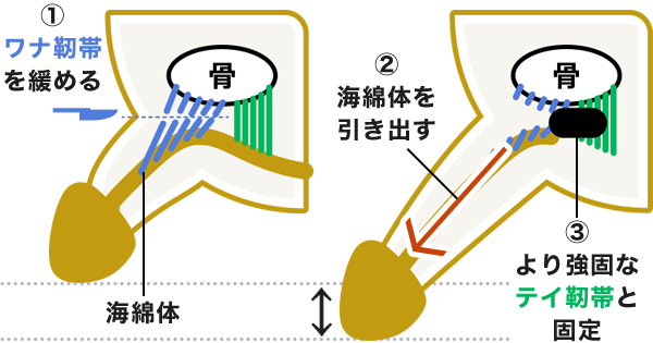 でかいちんこの基準とは？日本人平均や大きくする方法を解説 |【公式】ユナイテッドクリニック