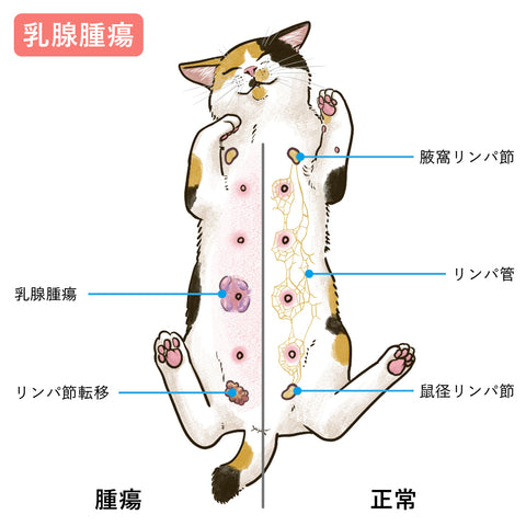 ✓大きく腫れて痛いできものがある ✓しこりのようなできものが気になる こんな肌トラブル、もしかしたらニキビではなく「粉瘤」かもしれません‼️  ニキビと粉瘤の違いは？🤔💭